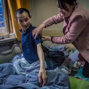 人工角膜最新进展，重塑光明的希望。