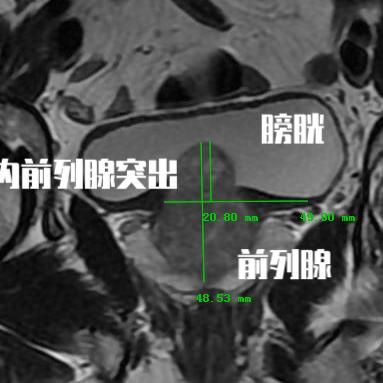 麻友圈最新版本下载，全新麻将娱乐体验